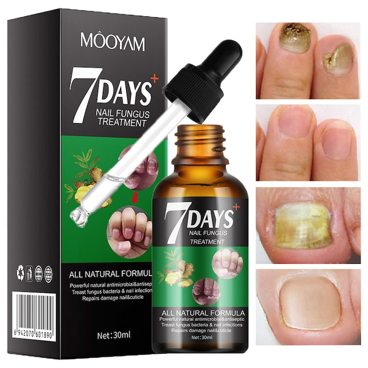 Tratament pentru ciuperca unghiilor Solutie reparatoare 7 zile Intareste si hidrateaza cuticula Stimuleaza cresterea sanatoasa a unghiilor 30ml
