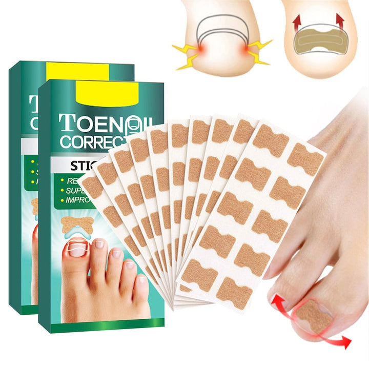 Set de 100 plasturi de corectare a unghiilor incarnate Axroad Mall Plasturi reparare unghii Material respirabil Confortabili Aderenta buna Antifungici Anti-infectie Portabil Netesut 1.3x1.8cm Bej