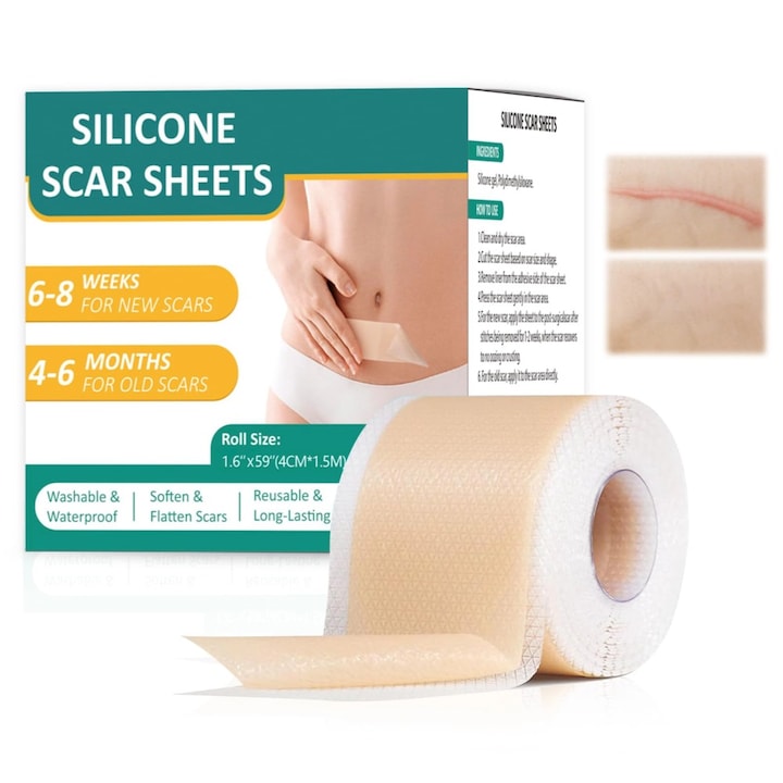 Plasturi din silicon pentru cicatrici plasturi din silicon de calitate medicala profesionala reutilizabili potriviti pentru cheloide cicatrici chirurgicale cicatrici de cezariana si arsuri 4 cm x 150 cm culoare nude