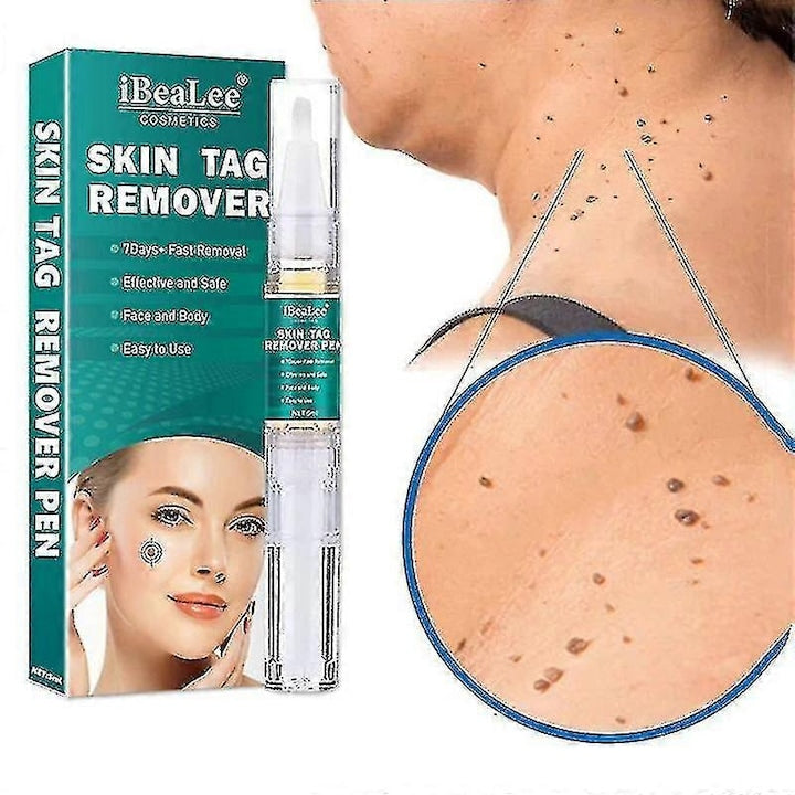 Stilou pentru indepartarea negilor 5 ml