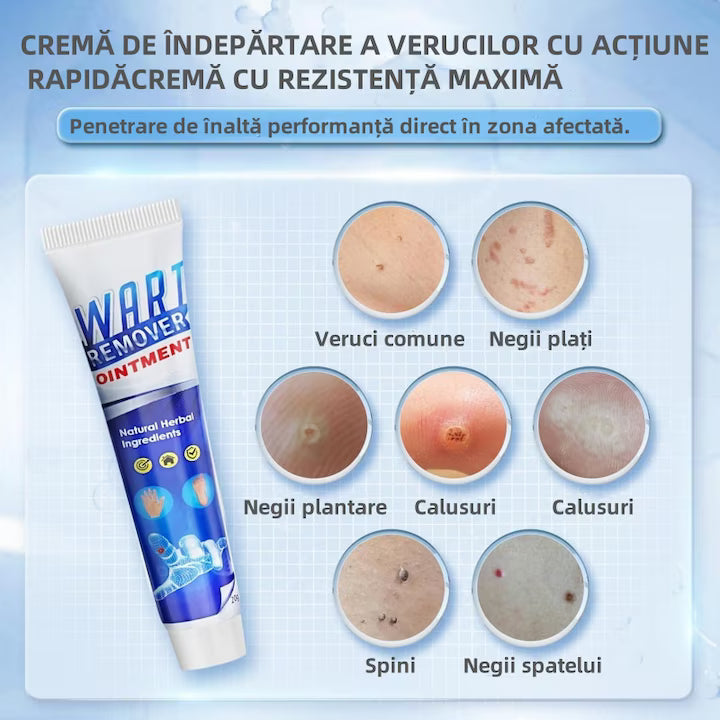 Cremă naturală pentru eliminarea negilor, petelor pigmentare și cicatricilor