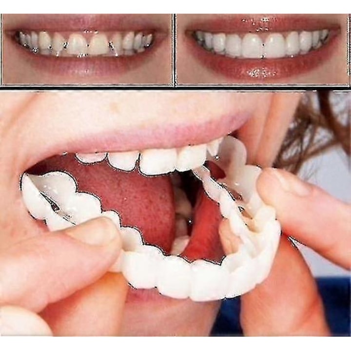 Set 2 proteze dentare silicon alb