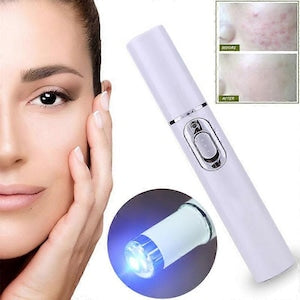 Spider vein removal pen, anti-acne, multi-color, 25x5cm