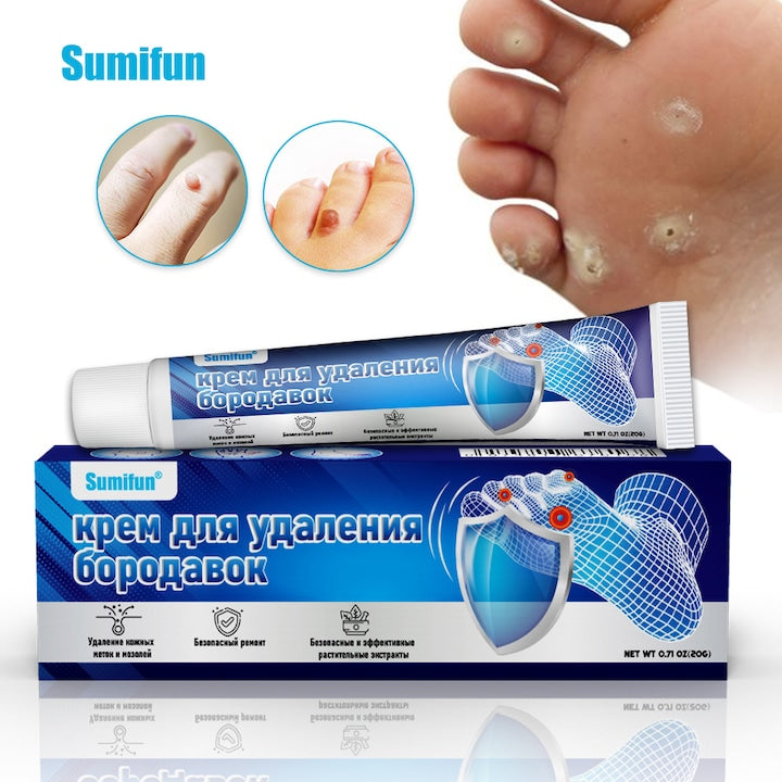 Crema pentru indepartarea negilor de la picioare indeparteaza negii de la picioare bataturi negi piele plata crema antibacteriana pe baza de plante indeparteaza bataturile