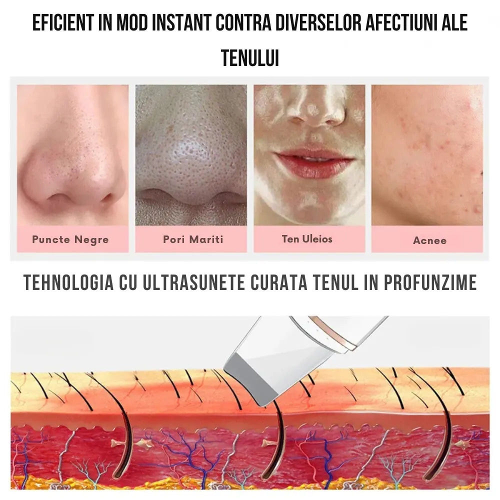 Aparat de Curatare Faciala cu Ultrasunete, ClearSkin, Indepartare Puncte Negre, Peeling