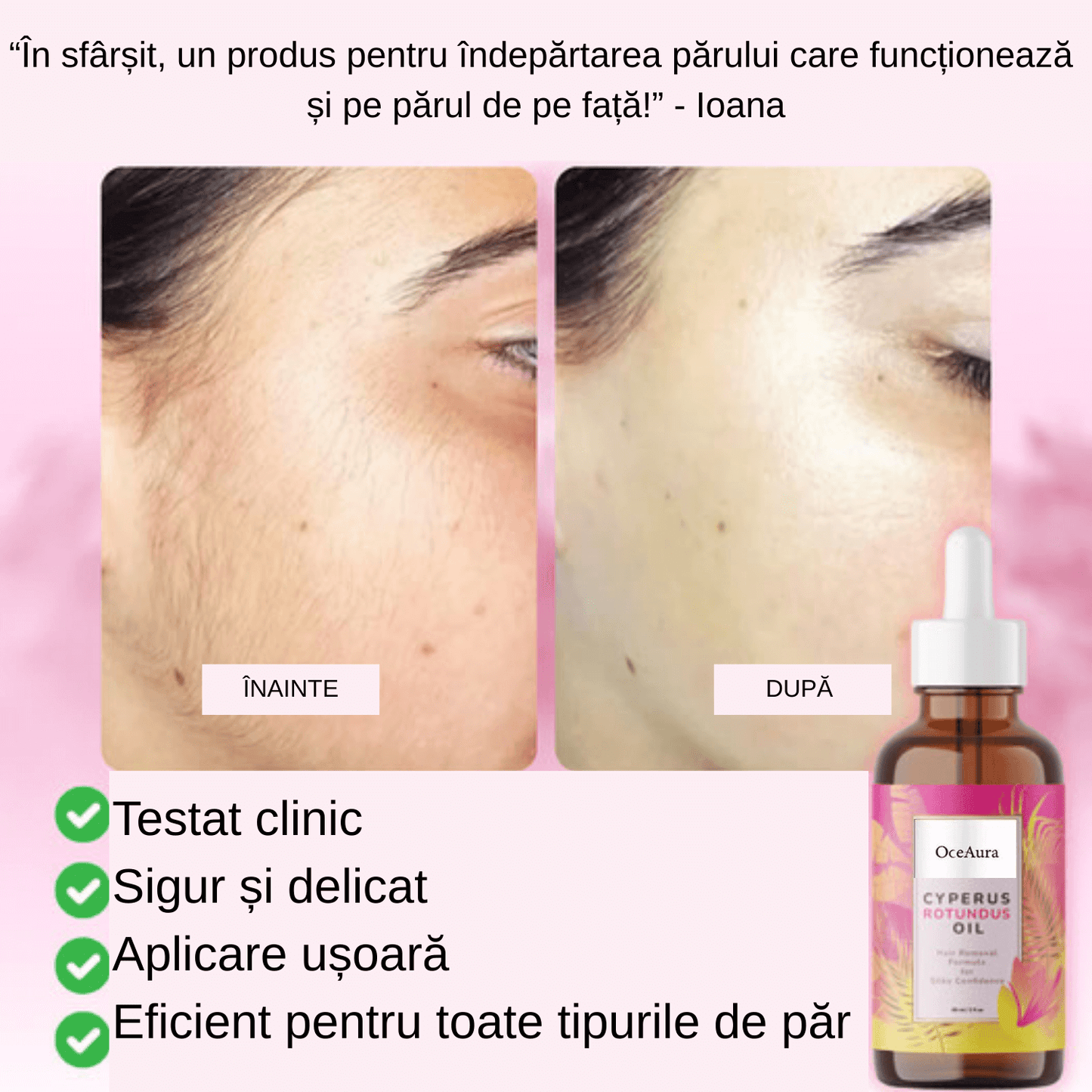 Ser Anti-Crestere Par Cyperus Rotundus