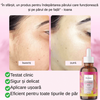 Ser Anti-Crestere Par Cyperus Rotundus