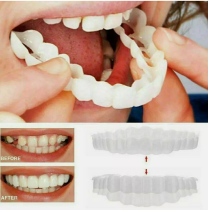 Zestaw 2 licówek dentystycznych, realistyczne sztuczne zęby