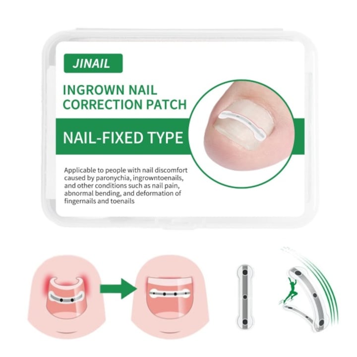 Tratament pentru unghia incarnata din silicon din aliaj de titan - Unghia incarnata  ameliorarea unghiilor curbate - Plasture si dispozitiv de fixare pentru corectorul unghiei incarnate