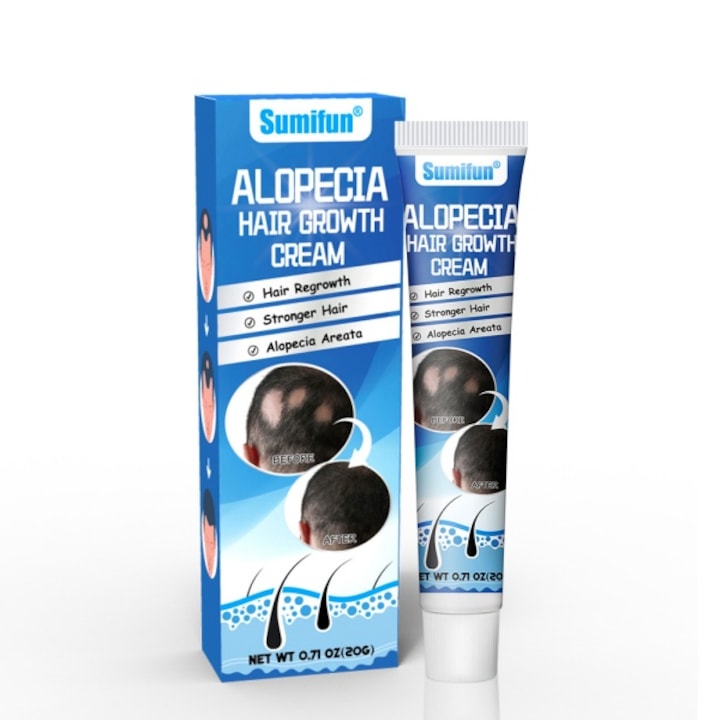 Crema pentru ingrijirea pielii capului Sophora flavescens crema pentru alopecia areata pentru cresterea parului  ulei anti-cadere a parului  crestere rapida a parului  prevenire