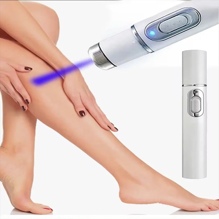 Dispozitiv Laser Tip Stilou pentru Varice – Terapie Eficienta pentru Vene Paianjen  Imbunatateste Circulatia Sanguina si Reduce Inflamatia
