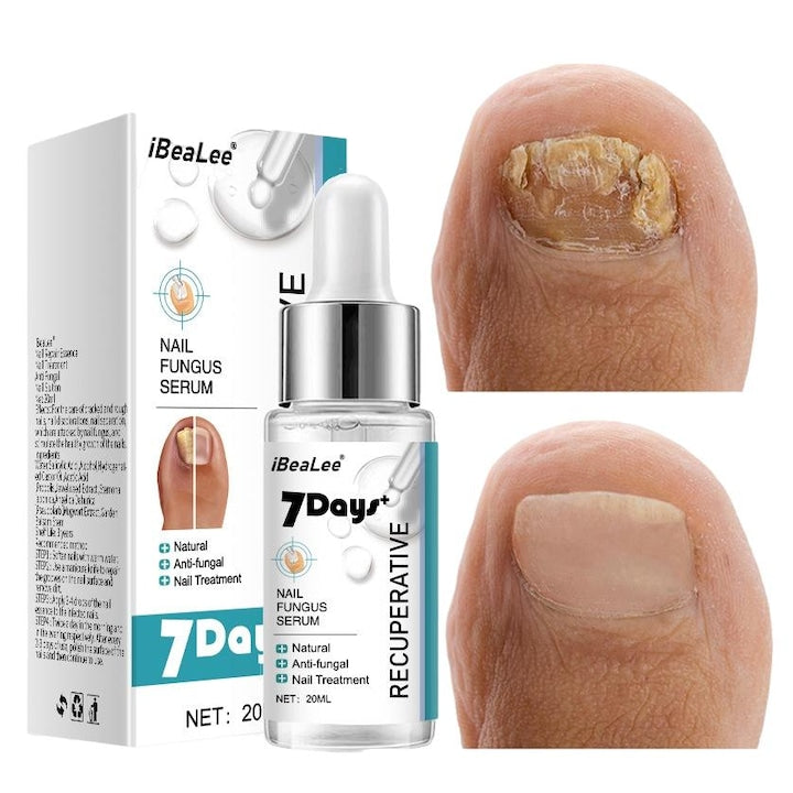 Tratament unghii IBEALEE  solutie antibacteriana pentru ciuperca unghiilor  imbunatateste unghiile deteriorate  20 ml  transparent