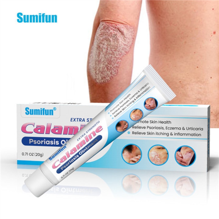 Unguent antibacterian  indicat pentru psoriazis  eczeme si herpes  dermatita  eczeme  arsuri  acnee  unguent calmant si anti-mancarime cu zinc