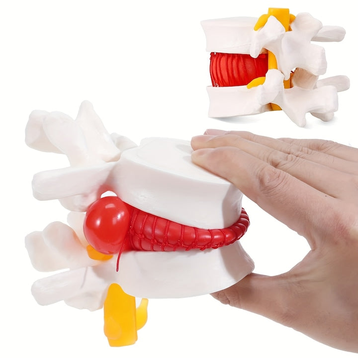 Model anatomic uman pentru hernie de disc lombar  Model de coloana lombara pentru predare si invatare - o modalitate excelenta de a demonstra discurile  1.5x dimensiune reala  2 discuri flexibile  WALALLA