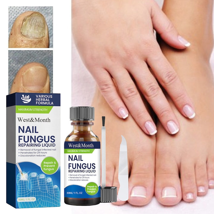 Tratament lichid pentru onicomicoza  Solutie de ingrijire a unghiilor  Solutie de ingrijire a ciupercilor unghiilor  Reparare blanda a unghiilor  10ml  Contine tablete abrazive pentru unghii  Solutie impotriva ciupercii unghiei  Antifungica  regeneranta