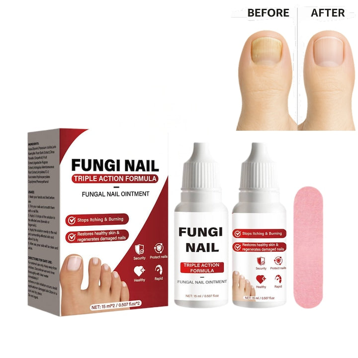 Set Tratament Antifungic pentru Unghii  Formula cu Actiune Tripla  Repara si Regenereaza Unghiile Deteriorate de Onicomicoza  Opreste Mancarimea  Include Pila  2 x 15ml