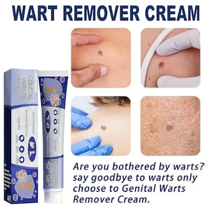 Crema pentru indepartarea negilor  20g  set de 1 bucata  fara cicatrici  uscare rapida