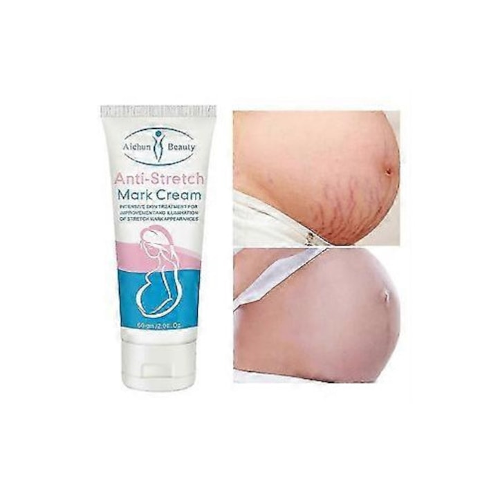 Crema pentru indepartarea vergeturilor  tratament pentru corp  anti-imbatranire  fermitate  200ml