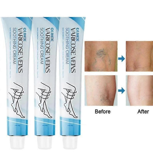 Crema pentru repararea venelor  20g  formula naturala  ajuta la vene varicoase  set 3 bucati