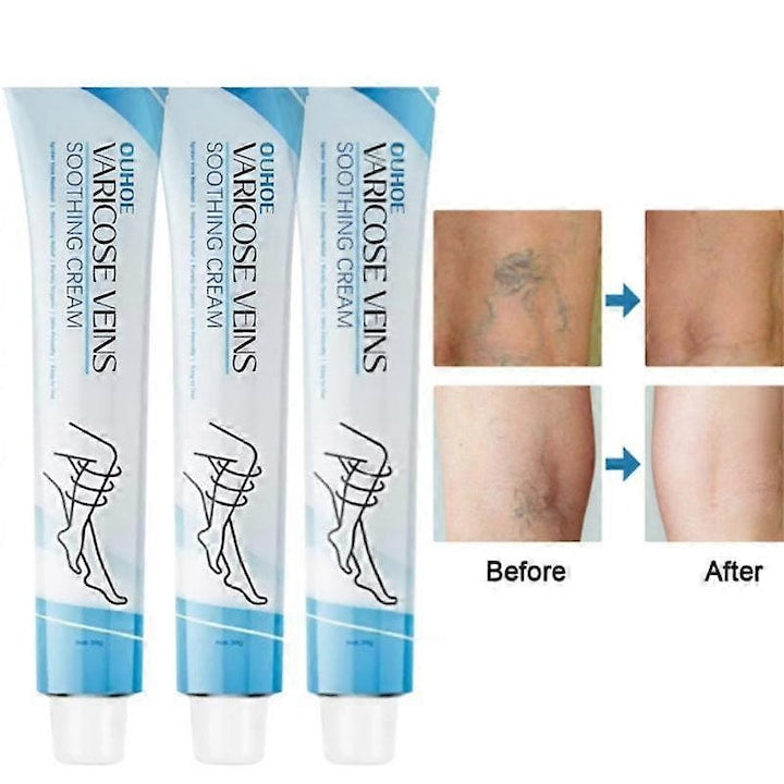 Crema pentru repararea venelor  20g  formula naturala  ajuta la vene varicoase  set 3 bucati