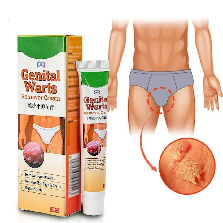 Crema pentru indepartarea negilor  pentru negi si papiloame AjieQaQ Eficienta in mod natural  indeparteaza rapid toate alunitele/negii/bataturile de pe picioare Potrivita pentru toate varstele  atat pentru barbati  cat si pentru femei 20 g